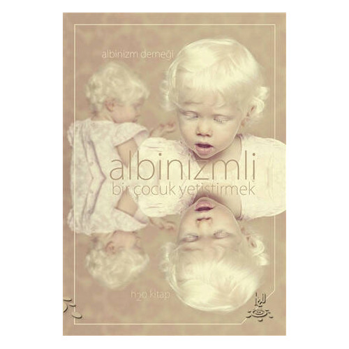 Albinizmli Bir Çocuk Yetiştirmek - Kolektif